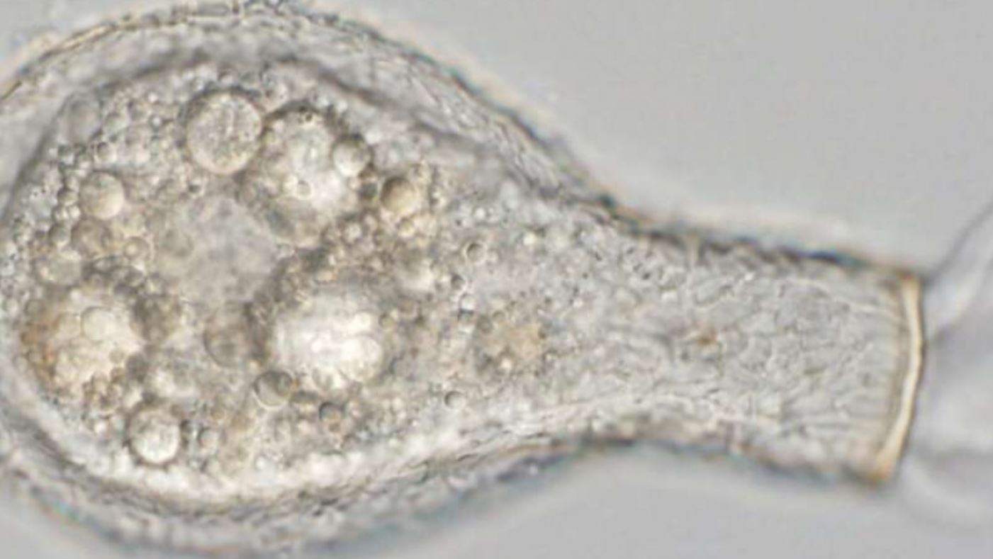 A live Padaungiella lageniformis wiggles its pseudopods. - Image Credit: Daniel J. G. Lahr, CC BY-ND