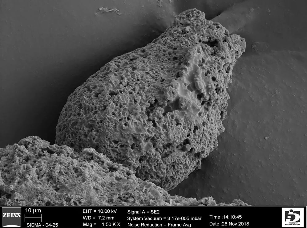 A scanning electron micrograph of a fossilized Ciclocyrillium torquata , sampled from the Urucum formation in central Brazil. - Image Credit: Luana Morais, CC BY-ND