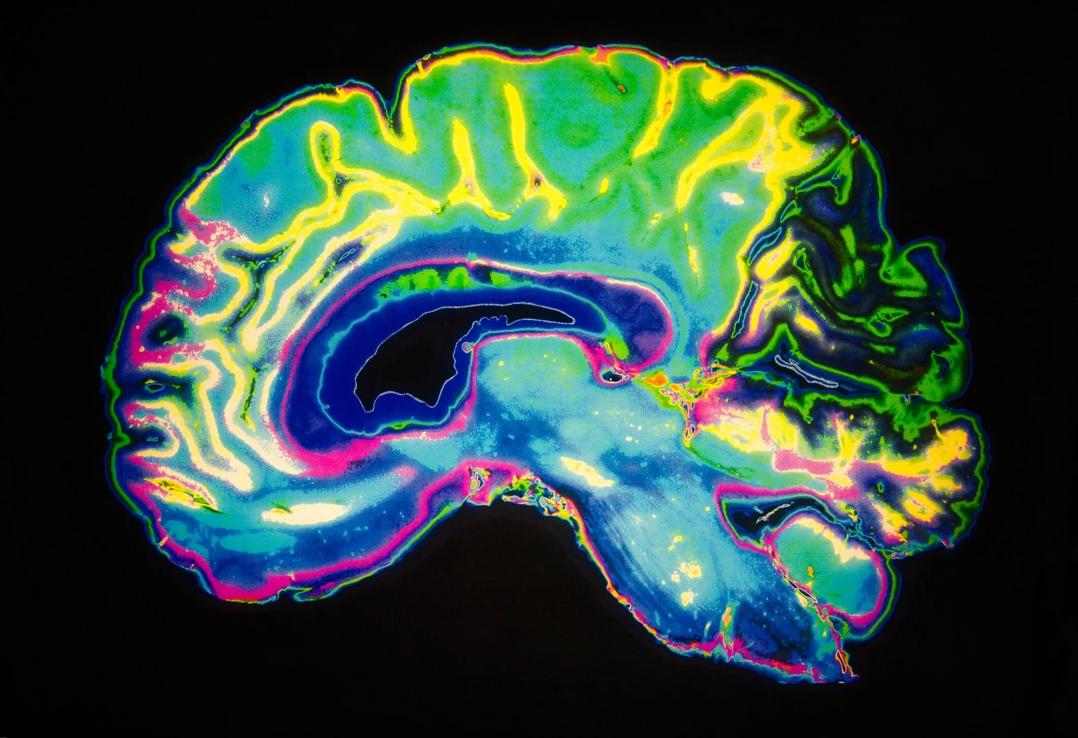 Scientists discovered that the purpose of sleep changes drastically as we reach the age of 2-and-a-half