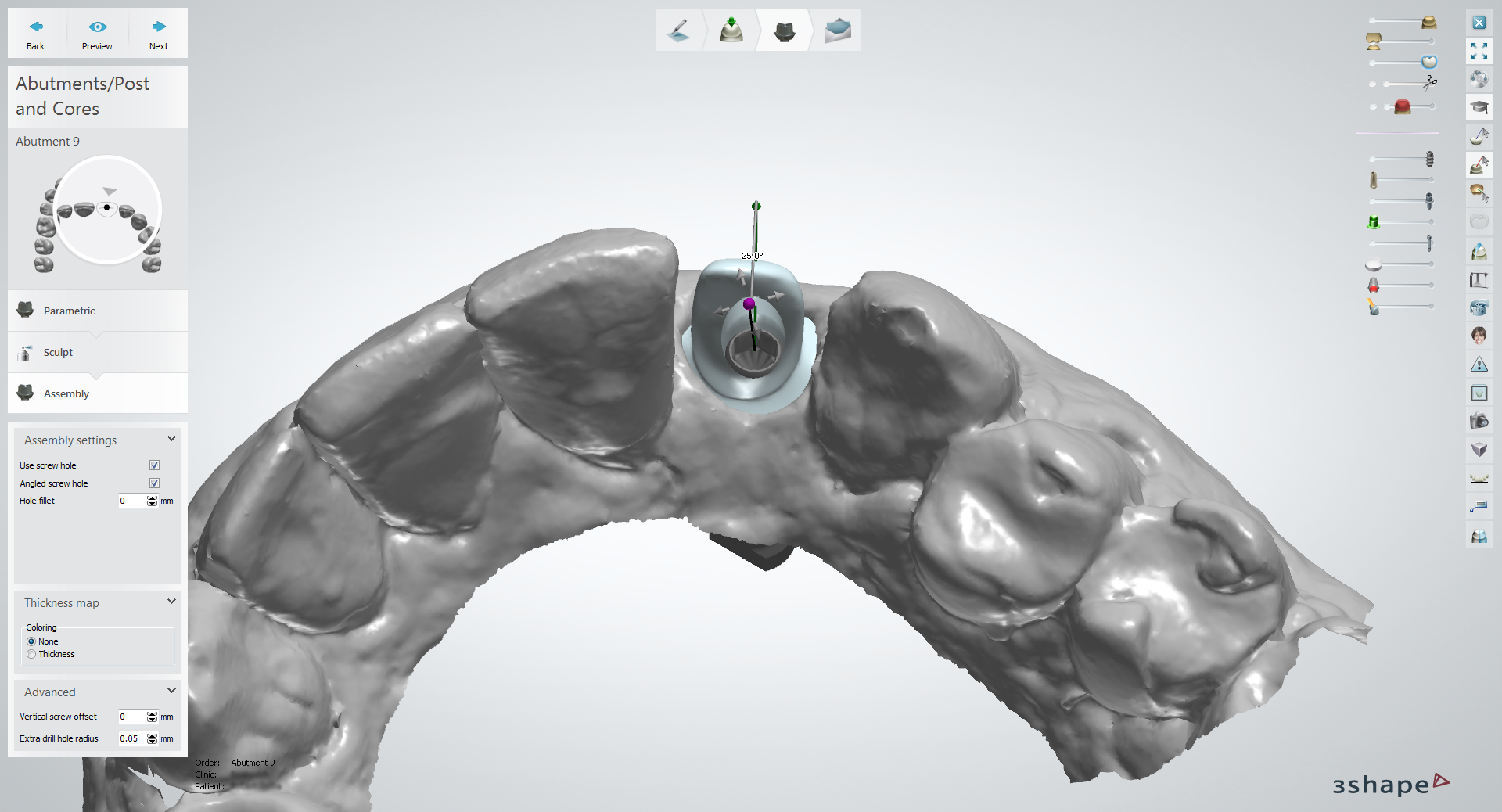 Completed design (incisal)