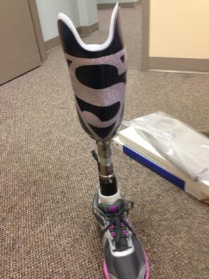 Here is a picture of my new temporary leg with art. They actually use T-shirts for the artwork on the sockets. They literally use the shirt by epoxying it in - it's not just the artwork that is used. I chose this one because Aaron bought me a purple Superman shirt after we got home so it seemed fitting and was handy. I like it because it's empowering to me. I like it because it's purple. I mostly like it because he gave it to me.