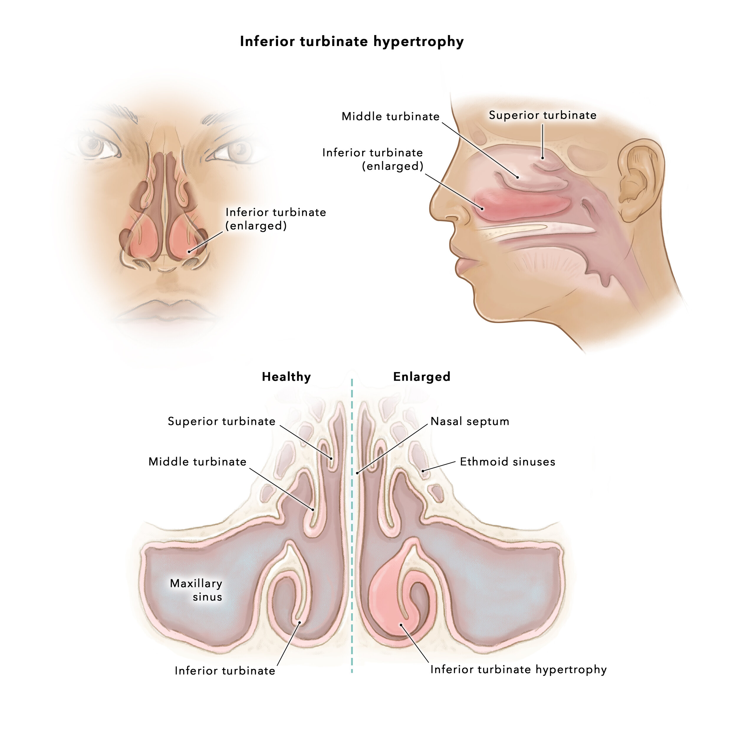 1_anatomy affected_labeled.jpg