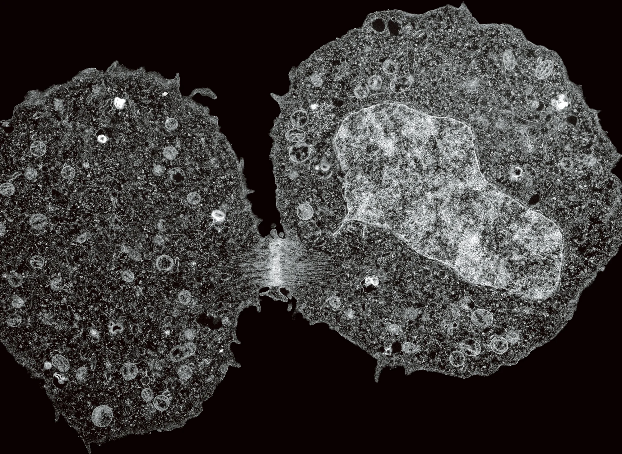 Dividing Cell