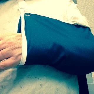 Practicing walking with a broken arm.jpg
