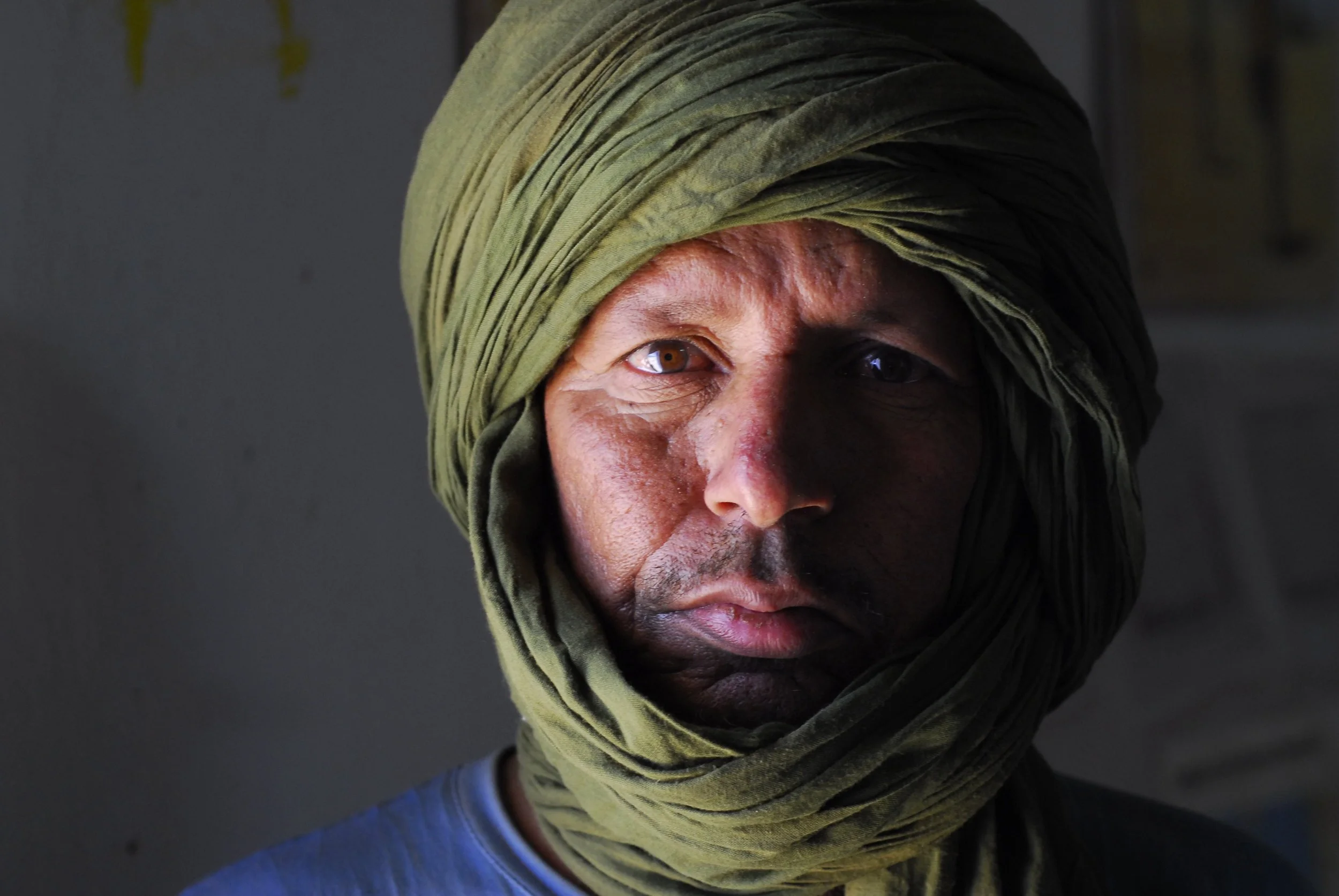 landmine-victim-western-sahara (Copy)