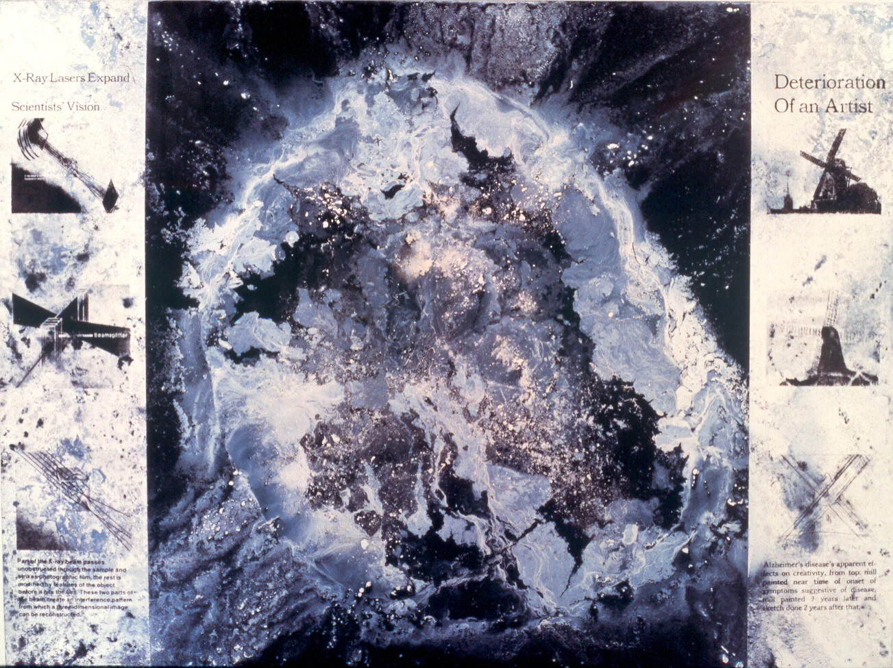 X-Ray Lasers Expand Deterioration, 1987