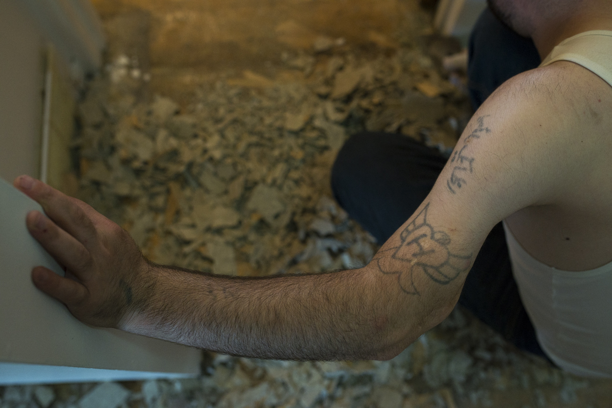  Left arm shows homemade tattoos along with deformity due to the injury. 