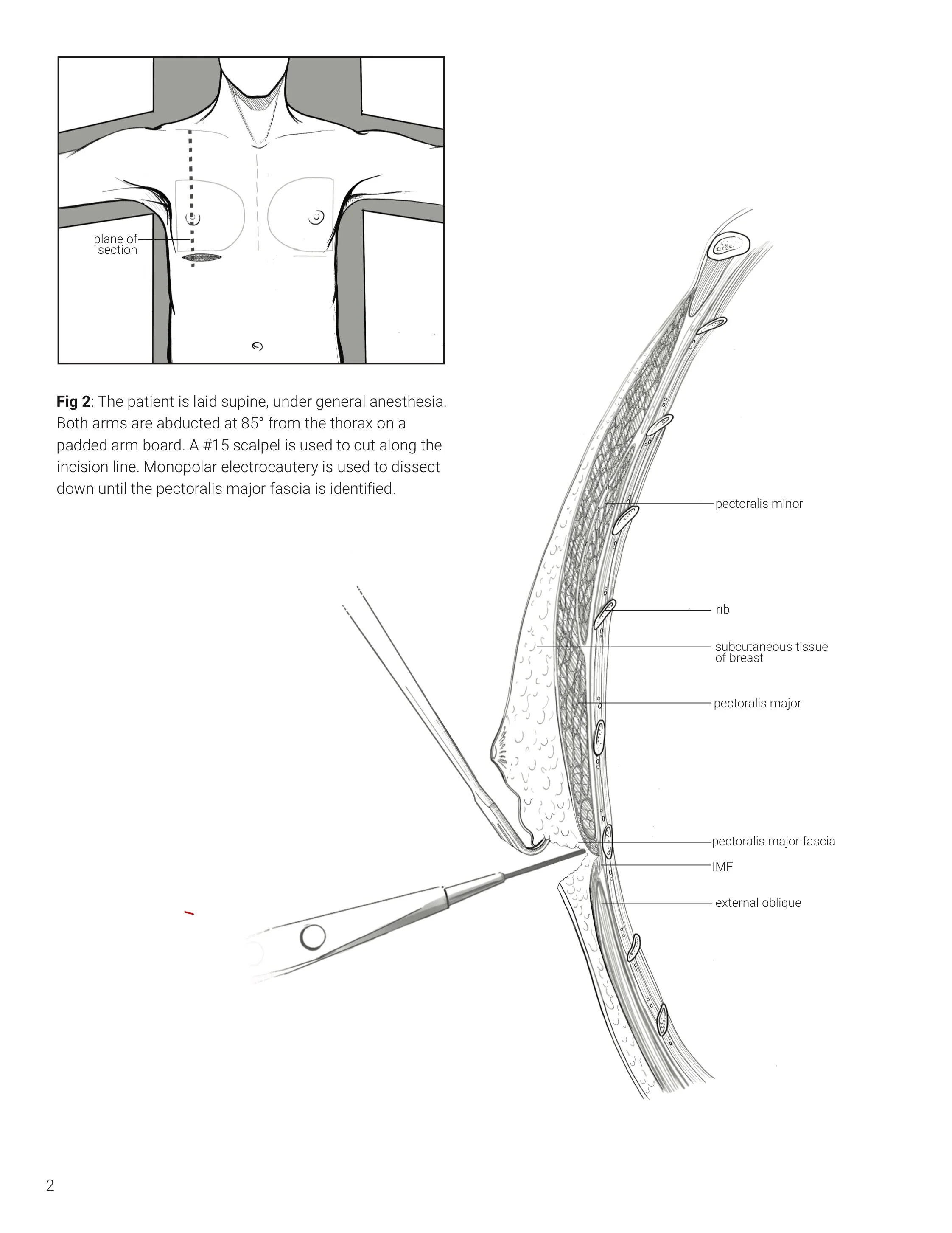 msc2001y_2019_assign5_v3_hung_s copy pg2-2.jpg