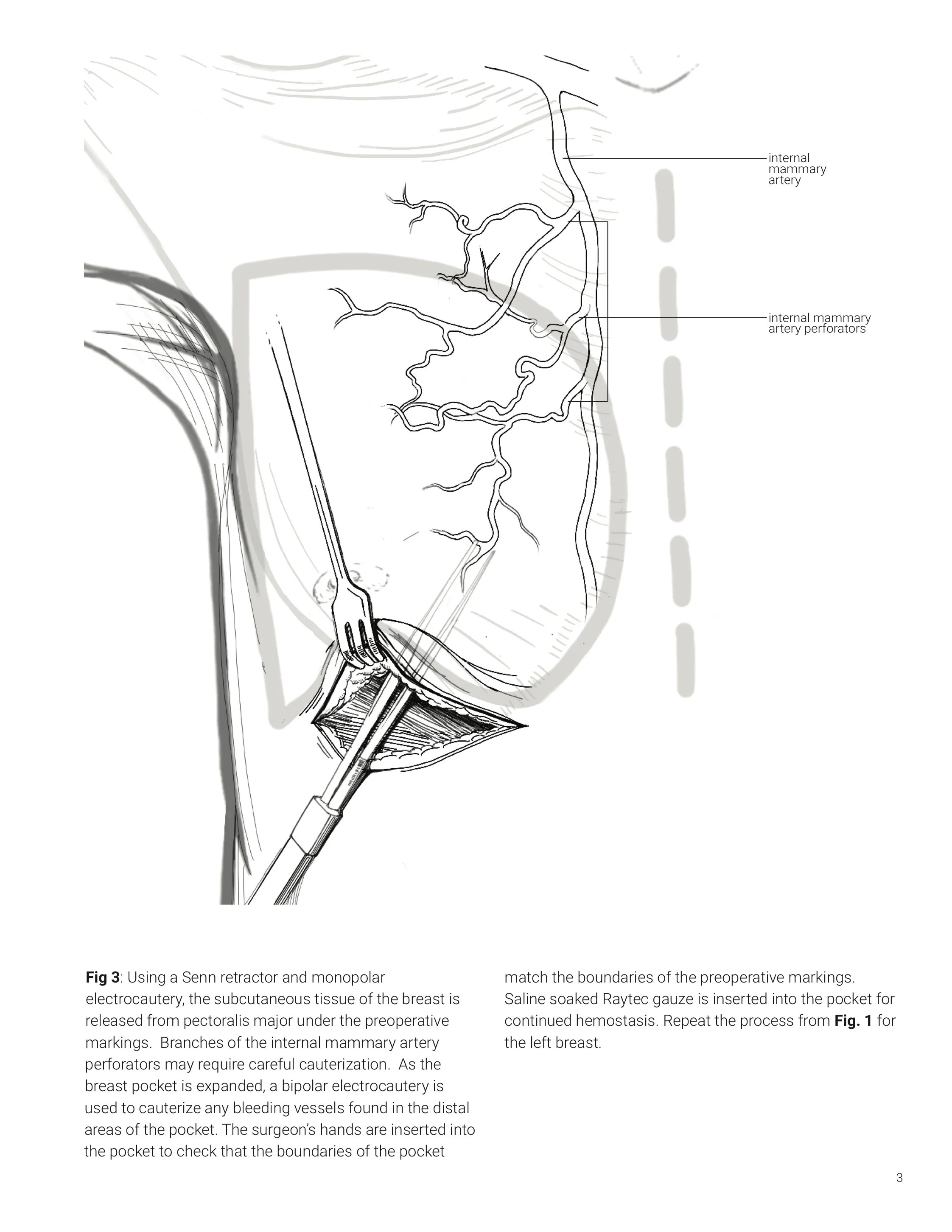 msc2001y_2019_assign5_v3_hung_s copy pg3-3.jpg