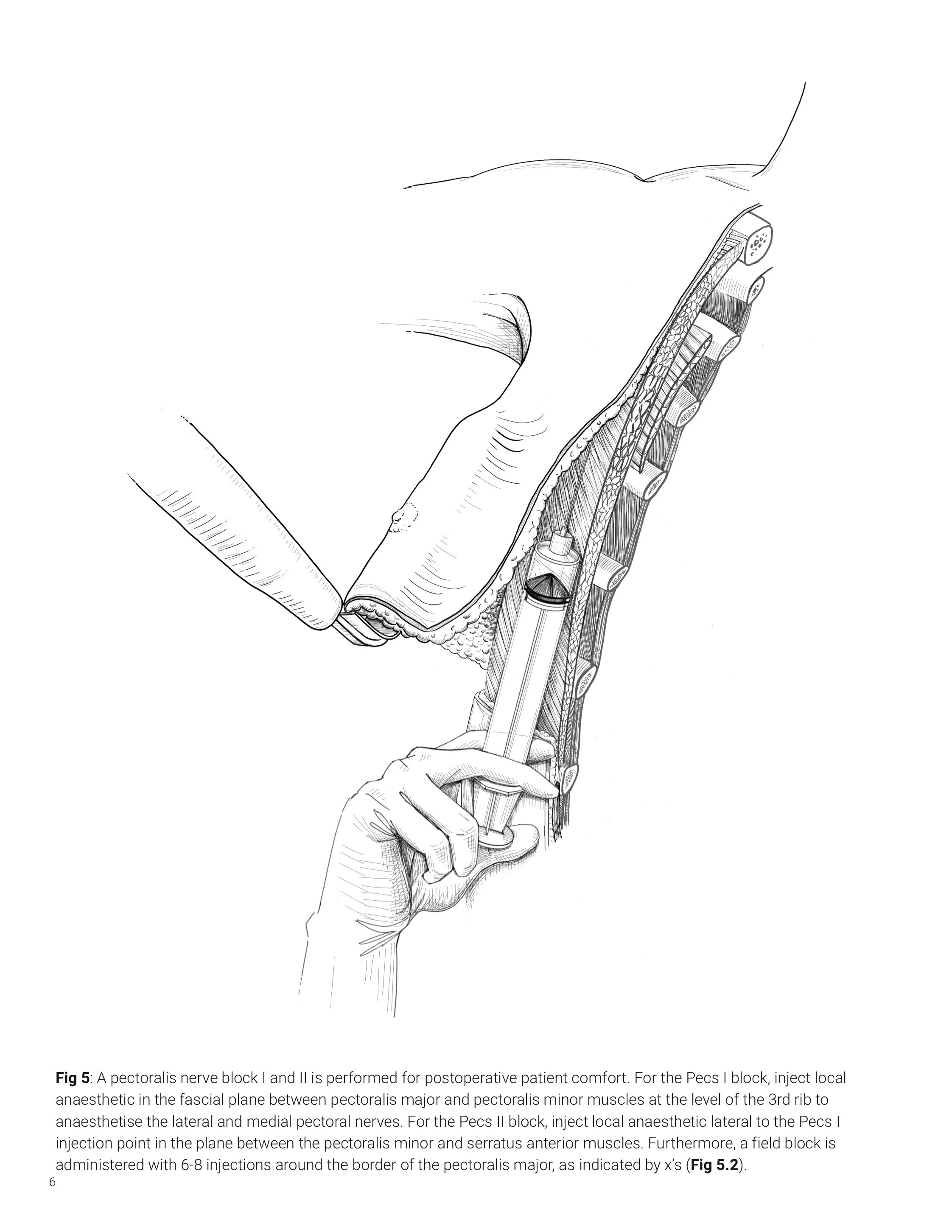 msc2001y_2019_assign5_v3_hung_s copy pg6-6.jpg
