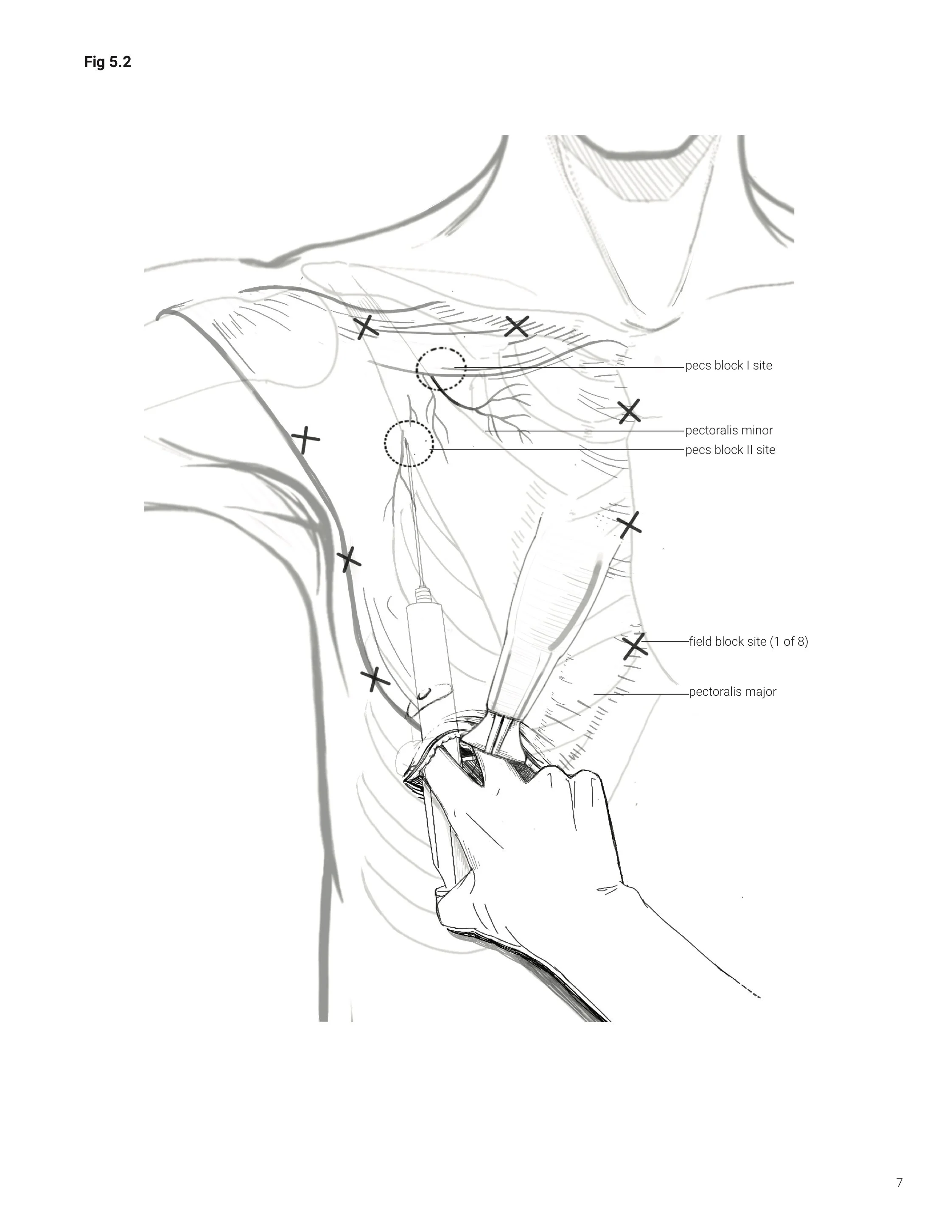 msc2001y_2019_assign5_v3_hung_s copy pg7-7.jpg