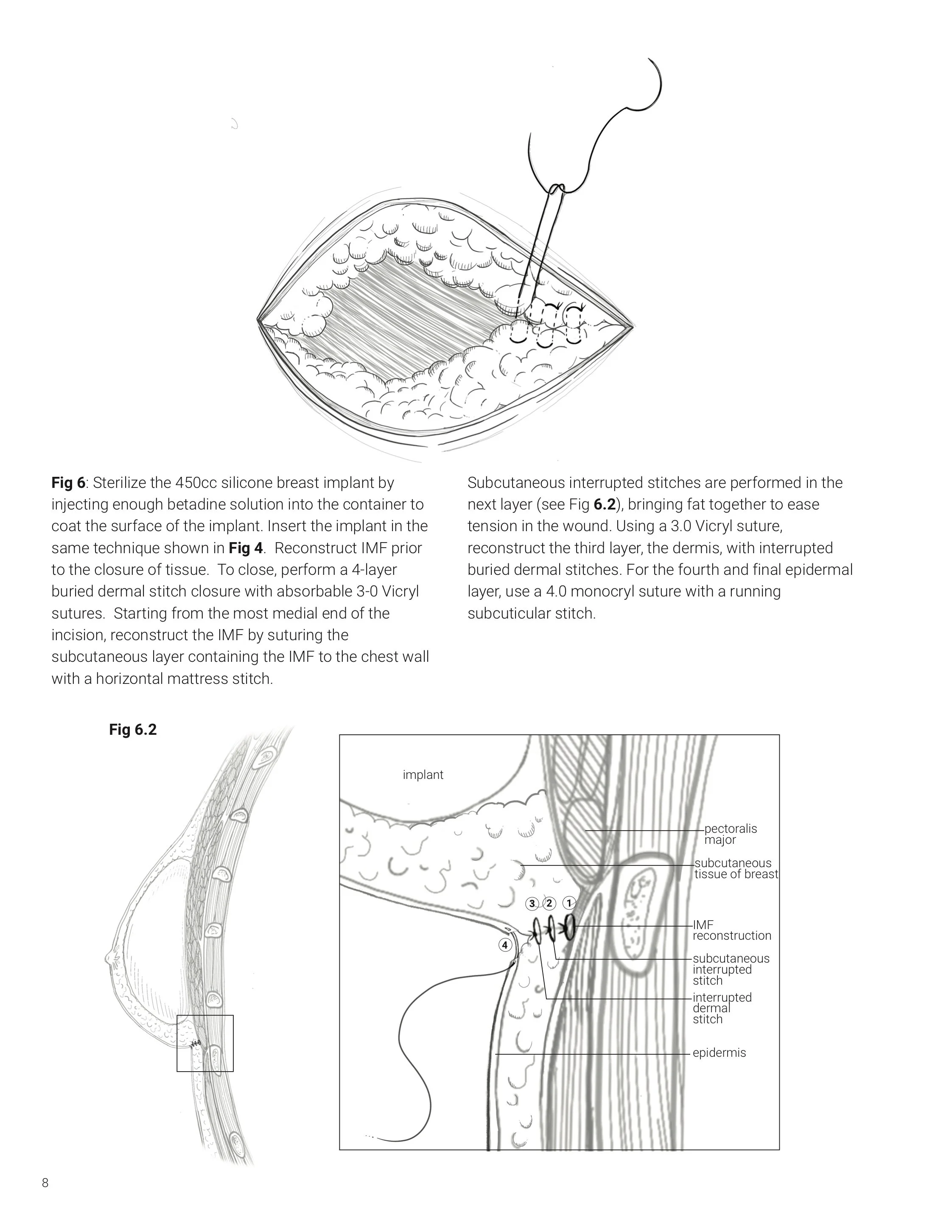 msc2001y_2019_assign5_v3_hung_s copy pg8-8.jpg
