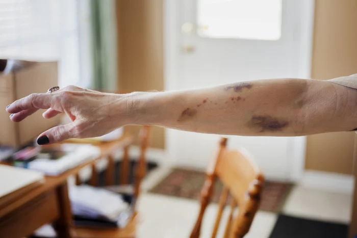 Intravenous Fluids , 2014