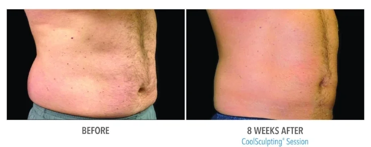 B&A-Haynes-AB-pt01-2Set-8wk-3QR-HiRes.jpg