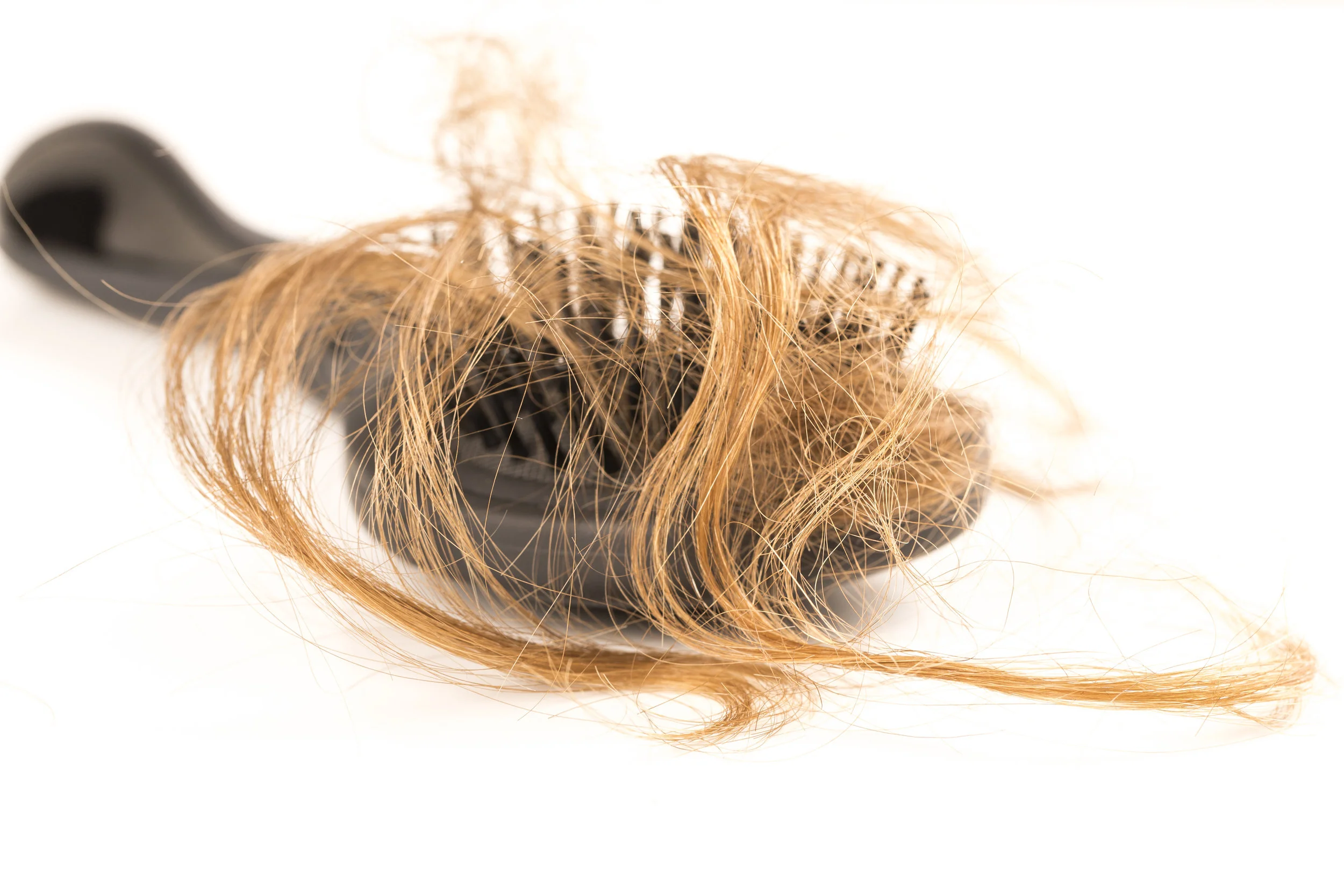 Perte de cheveux, perruque et prise en charge personnalisée 