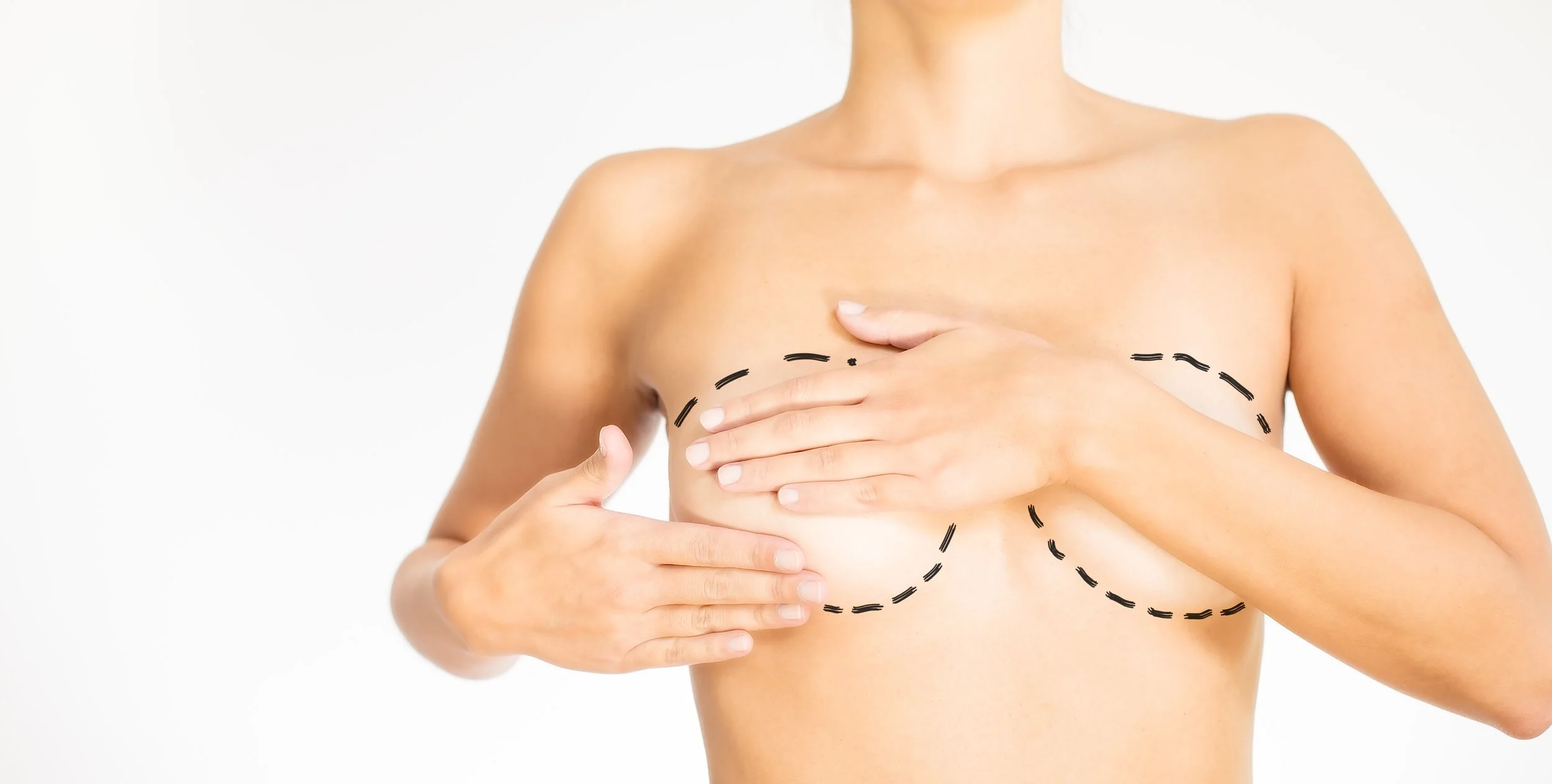 La reconstruction après un cancer du sein 