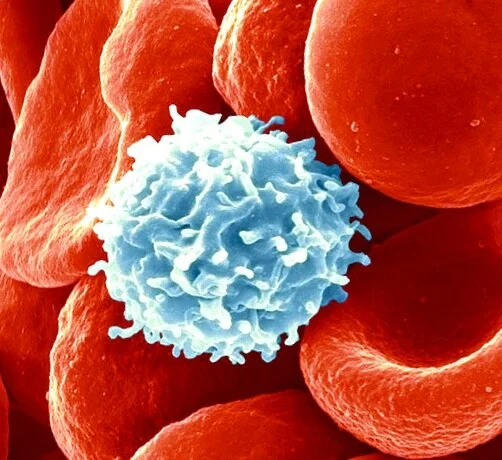 Qu'est-ce que l'immunothérapie ? 