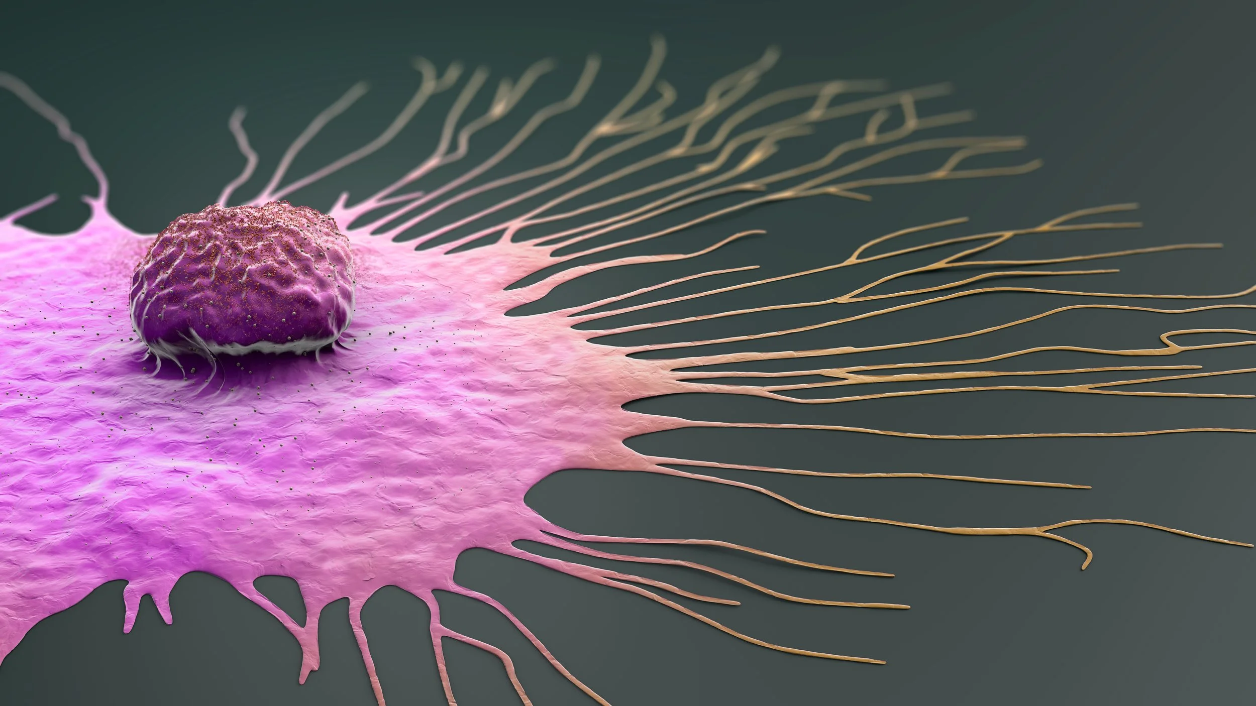 Qu'est-ce que le cancer du sein métastatique ?
