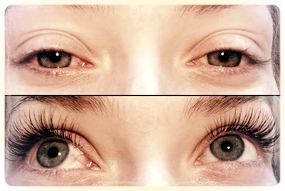 Melanie Before and After