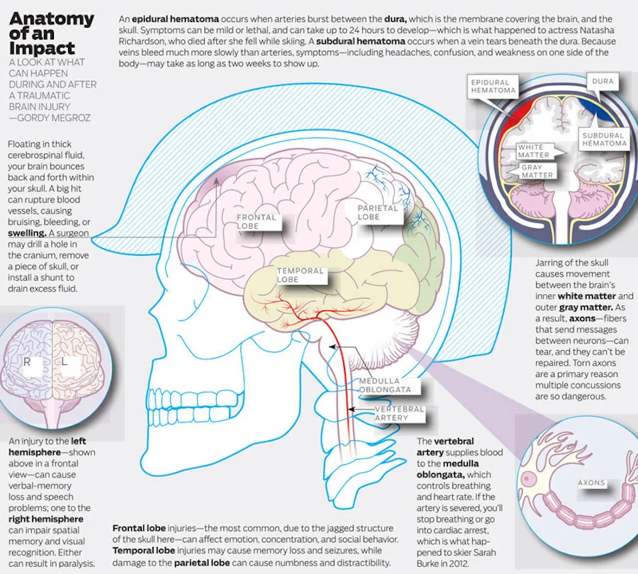 Anatomy of an Impact (click to expand)
