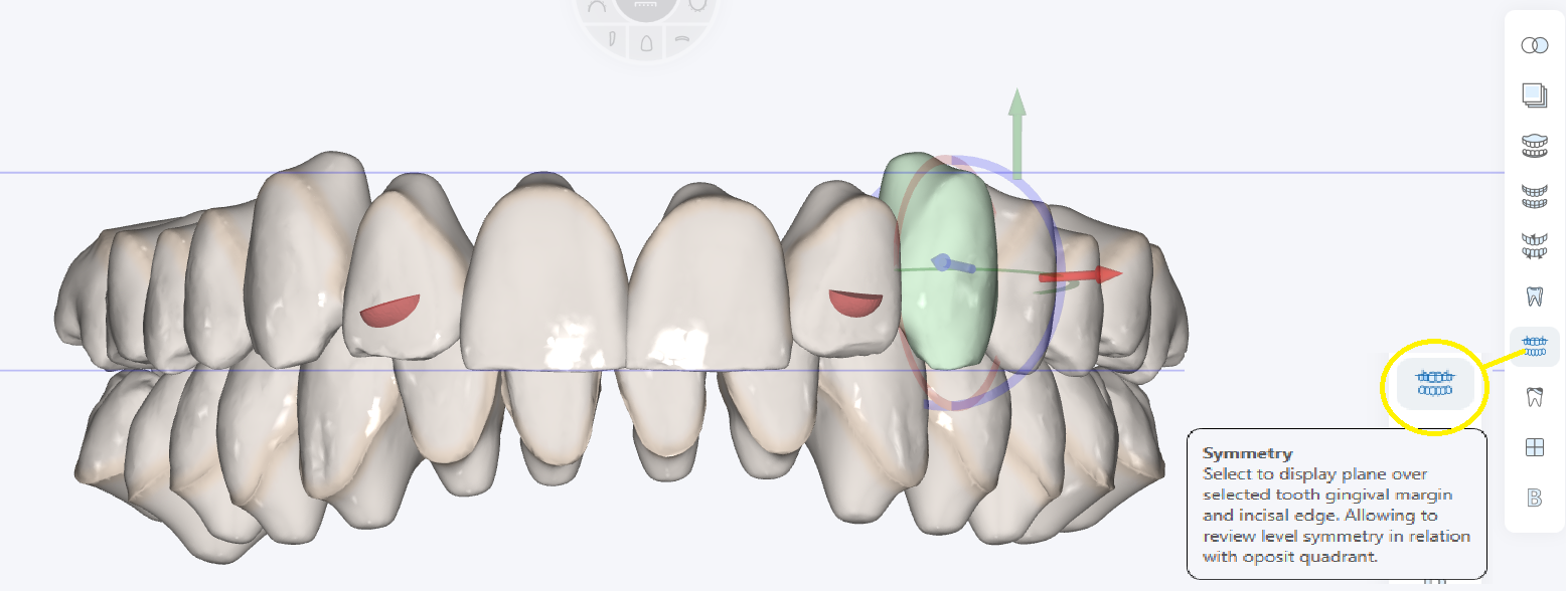 Note: Planes will travel as you move the teeth directly with tooth manipulation tool or controlled tooth movement tools.