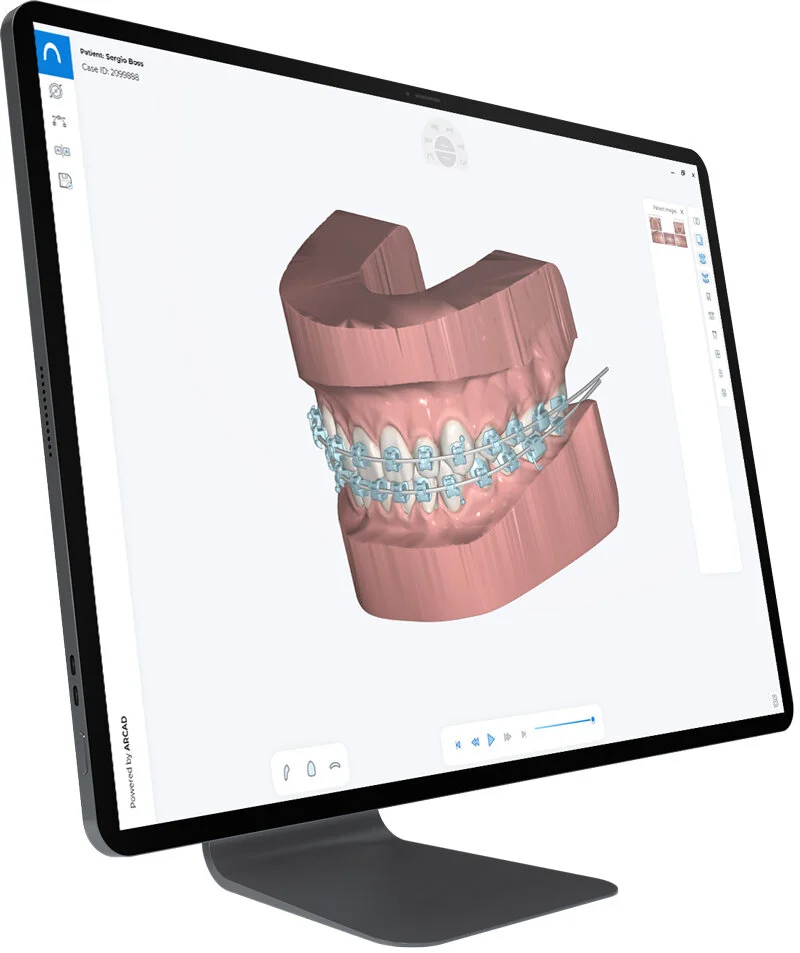 In-Office Clear Aligner — ArcadLab