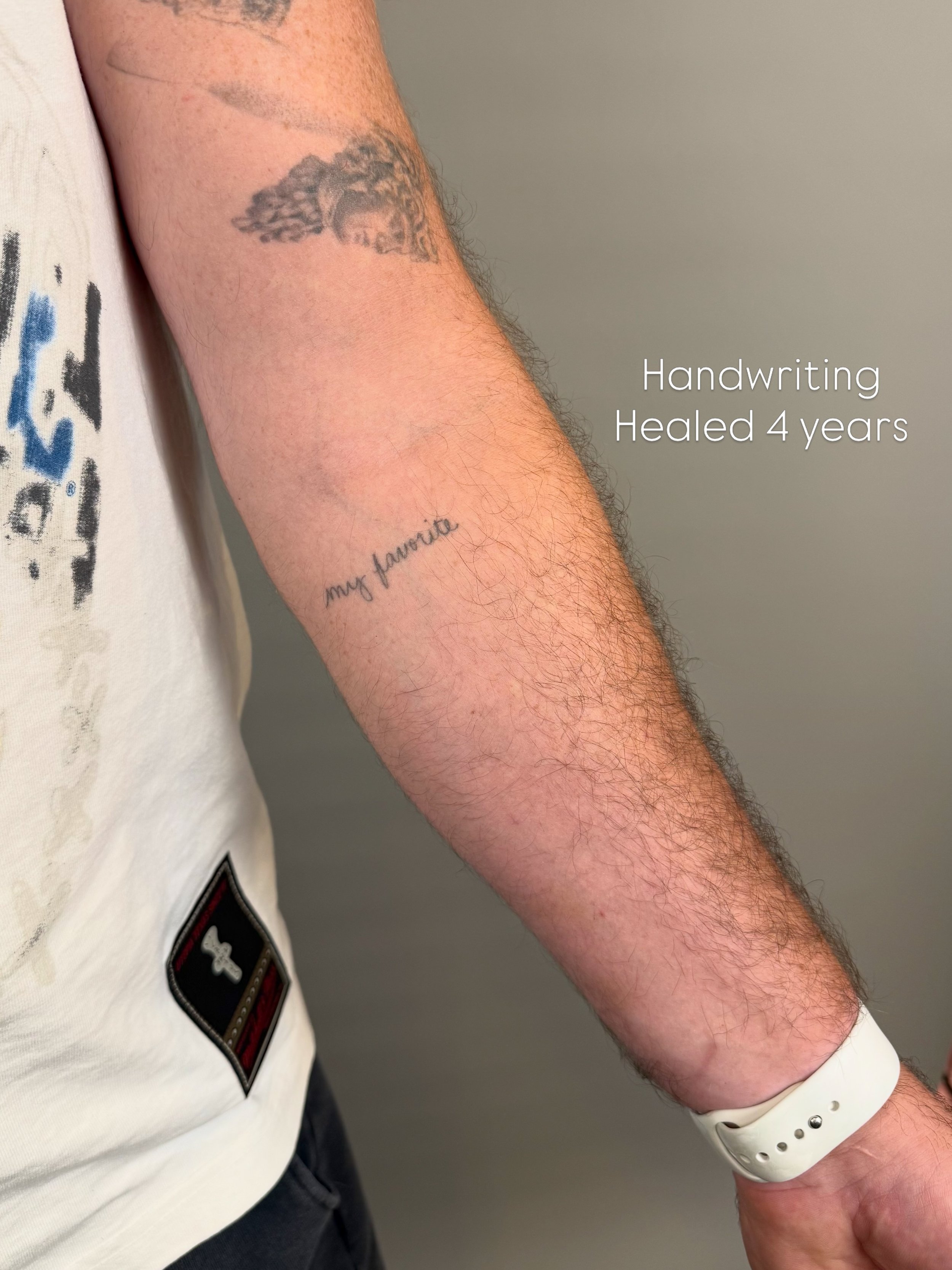 Single needle handwriting healed 4 years 

Thank you, Brian!

#nofilter #singleneedletattoo #handwritingtattoo #healedtattoo #finelinetattoophiladelphia