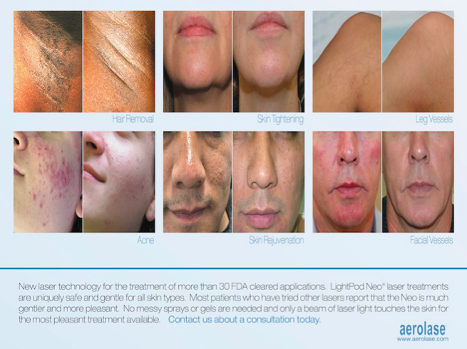 We are VERY excited to introduce the Aerolase LightPod Neo to our practice. This is laser safe to use in all skin types, even the most pigmented. We can now offer you more effective options for laser hair reduction , acne/ acne scars , melasma , skin redness , skin rejuvenation, and many other conditions . Please contact us TODAY to find out more about our new laser and the great introductory package discounts (10-15% off). 