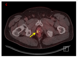 pet ct scan image.png
