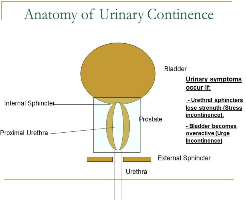 radiotherapy prostate cancer complications