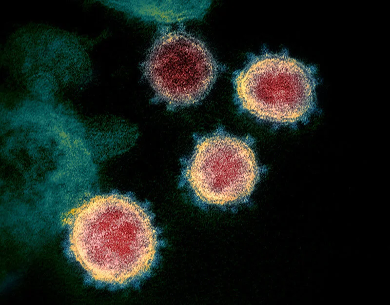 MSU study on monitoring wastewater for coronavirus