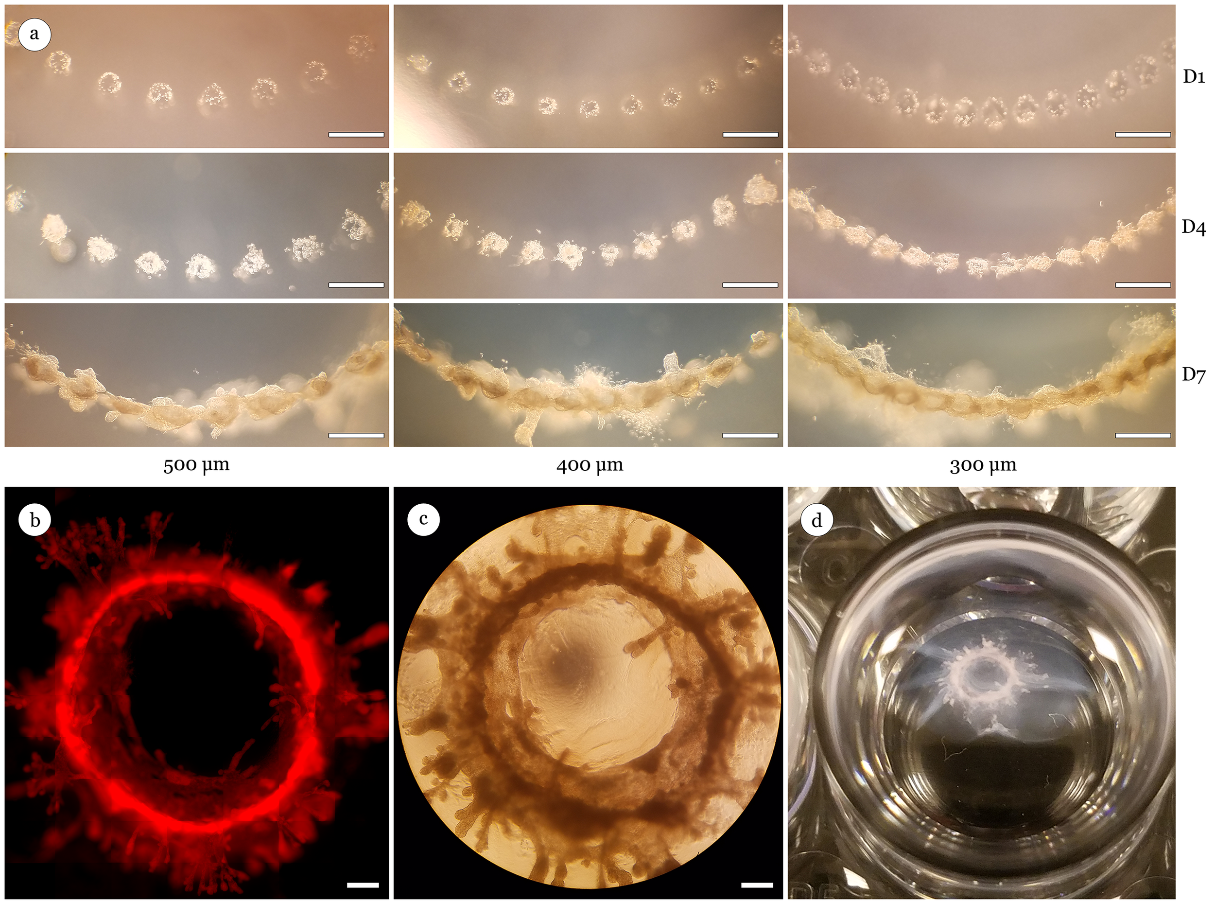 Directed printing of non-linear organoids. (a) MCF-12A cells (40 cells per deposit) printed in a radial pattern with print spacings of (a) 500μm, 400μm, or 300μm. Images of cell clusters illustrate the ability to direct large scale mammary structures within 7 days using additional geometric configurations. (b) Fluorescent image of bioprinted, RFP MCF-12A cell clusters 14 days post-print demonstrating fusion of individual organoids into a contiguous circular organoid. (c) Brightfield image of large circular organoid 14 days post-print. (d) Example of a large circular organoid inside 24 well culture plate 24 days post-print measuring ~4mm in diameter. Scale bar 500μm.