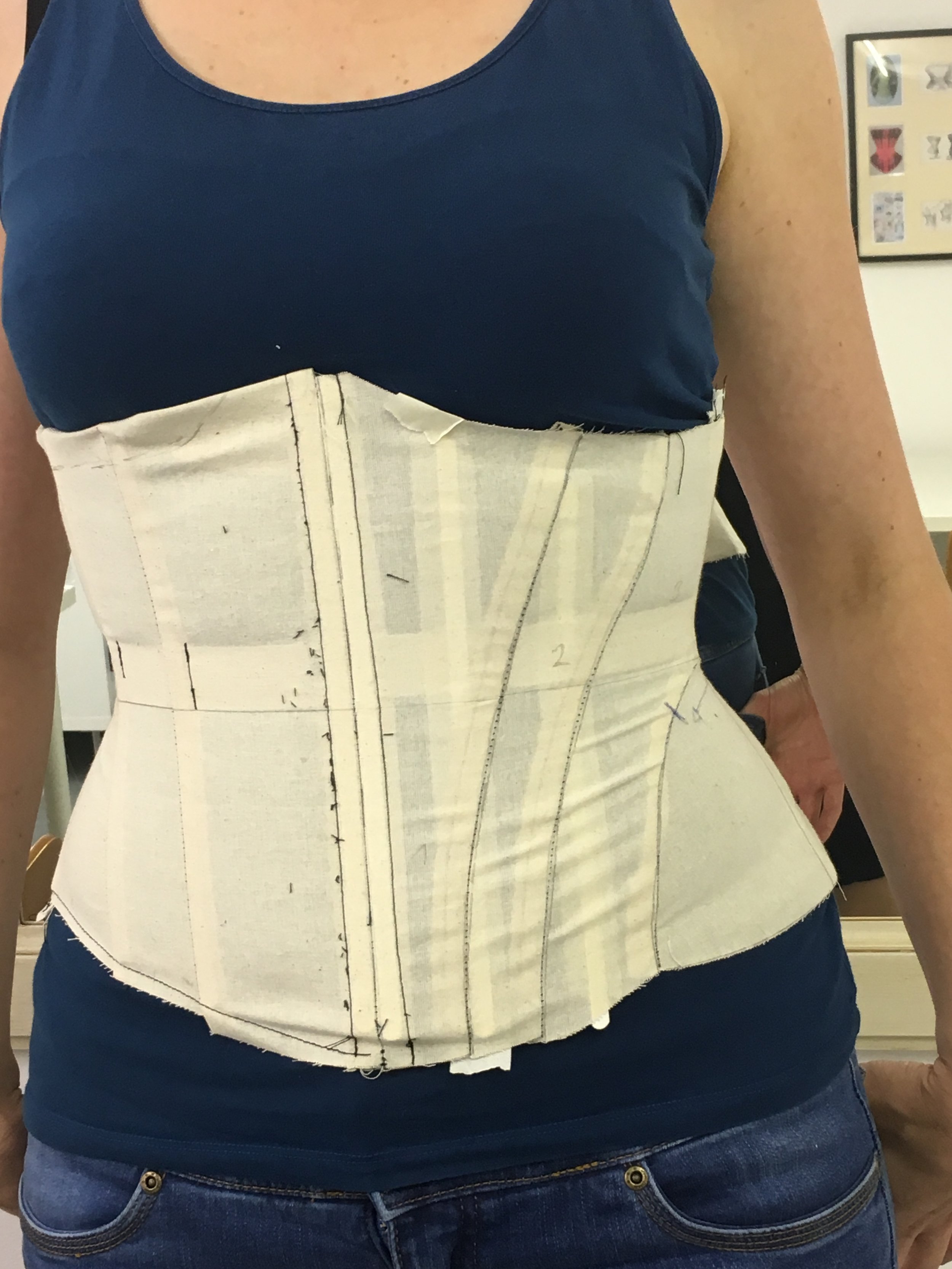 Can You Wear A Waist Trainer If You Have Scoliosis Authentic