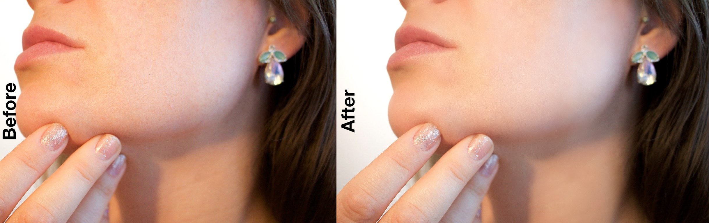 Before after Skin.jpg