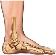 flat feet.jpg