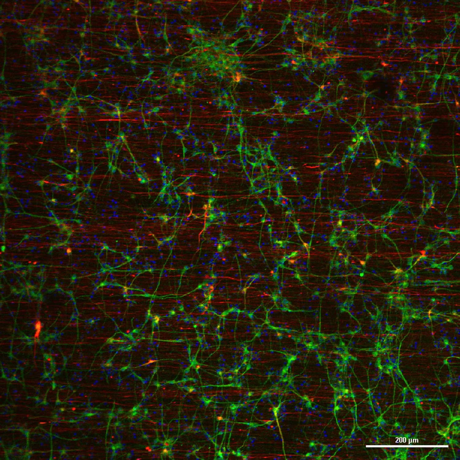 Normal-nanosurface-dopaneuron-D21-NF-r-MAP-2-g-nuclei-b-10x-1.jpg