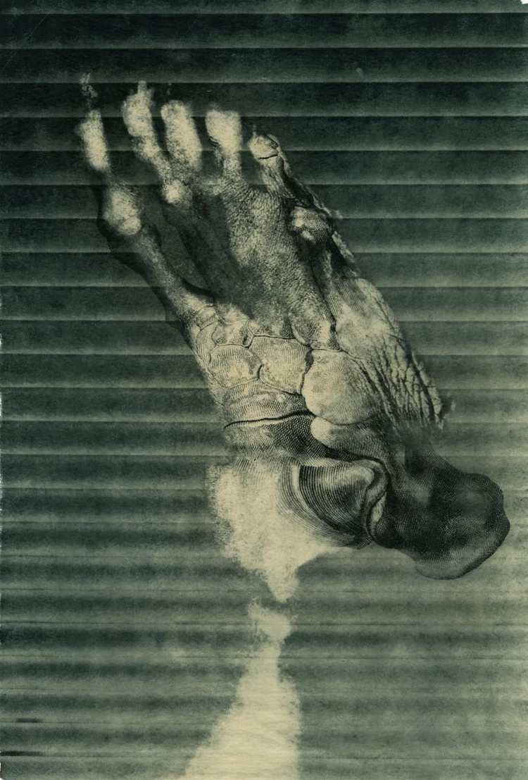 "Neuropathy II," Photo Intaglio, 21" x 15," 2017