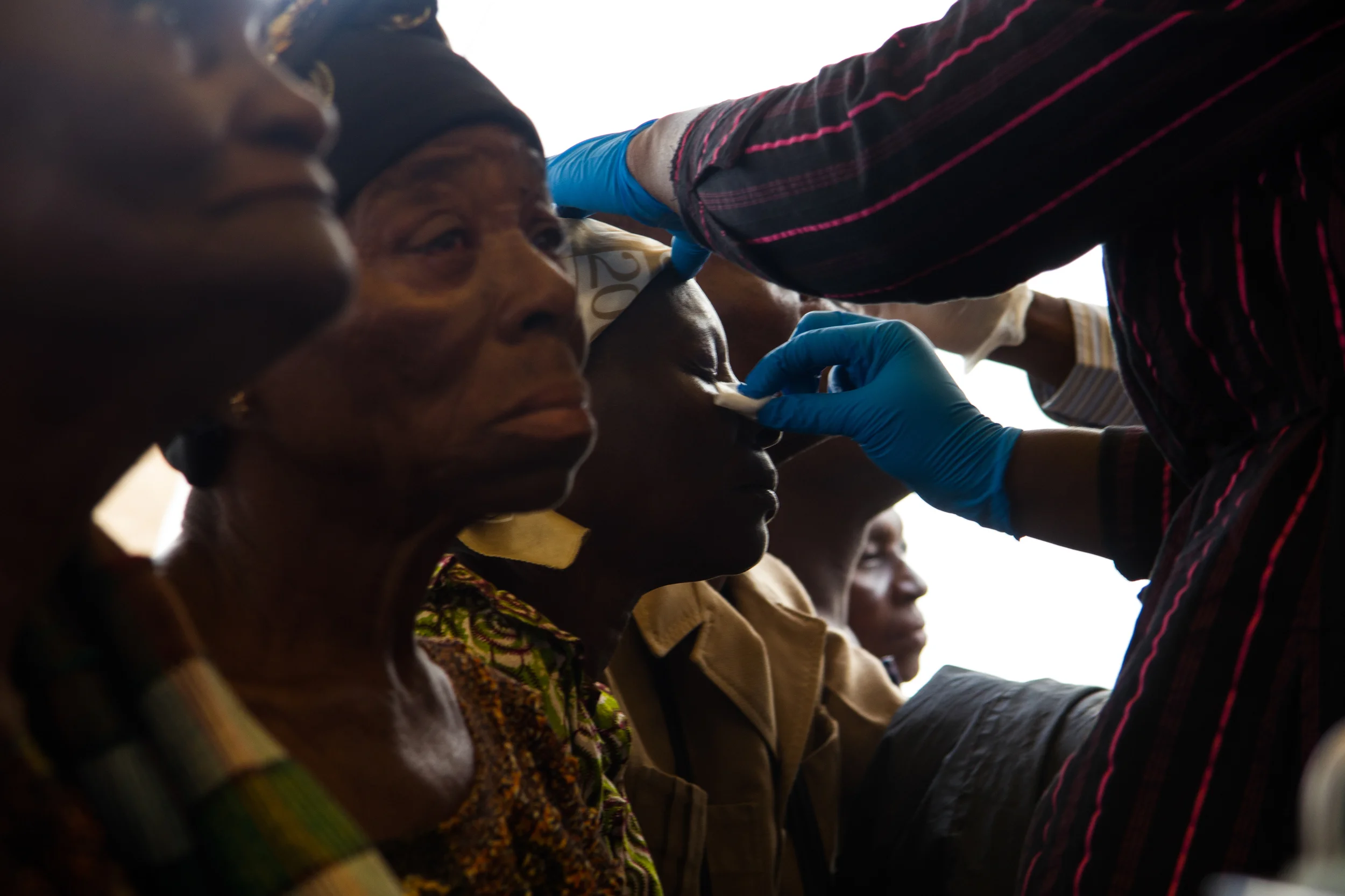 While the series of screenings and post follow ups is a long process, the surgical procedure takes only four minutes. Dr. Wodome, an eye doctor trained my Mercy Ships, cuts through a few layers of cells and inserts a small lens into where the cataract had been. They dilate the pupil and center the lens right on top of that. 