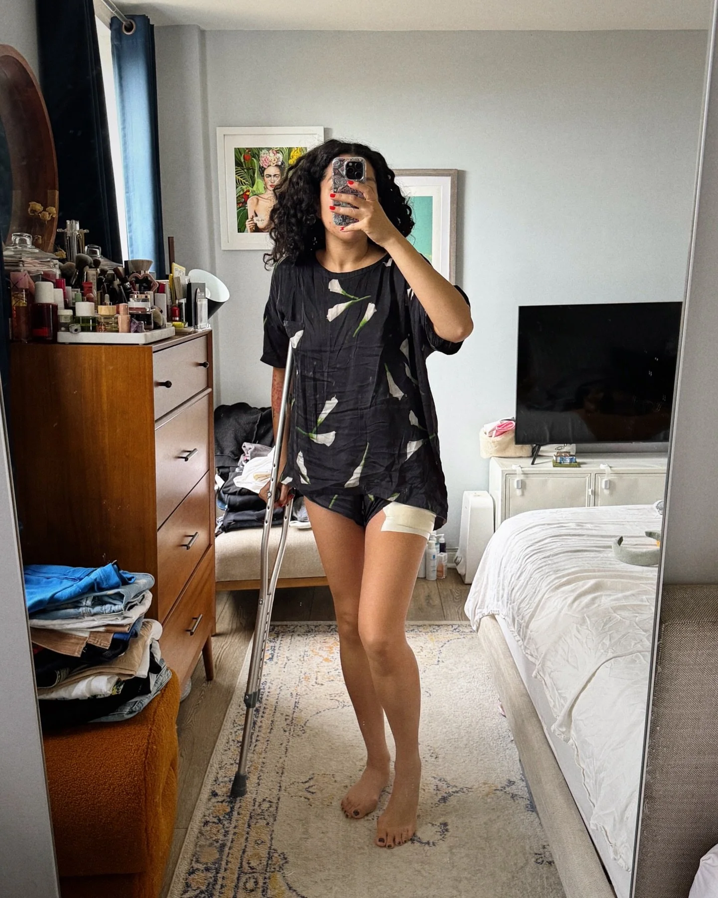 October 2025. Went from taking 10k+ steps daily to barely hitting 5k and sporting a cane. But finally on the road to recovery. #photodump