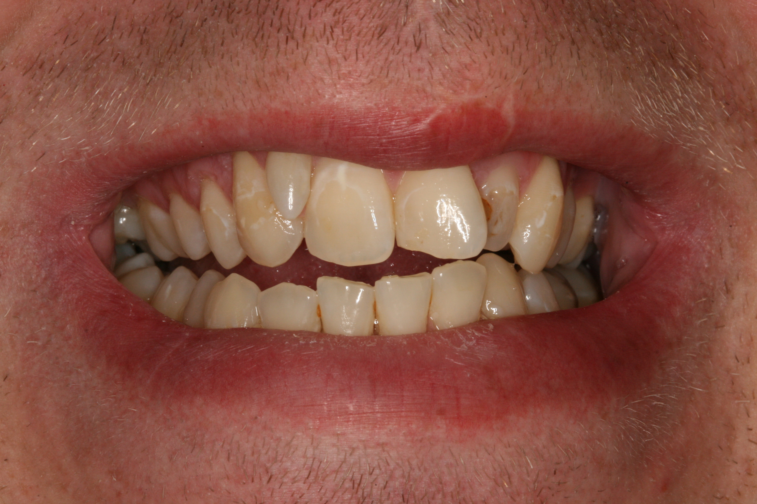 The Tuddenham Road Dental Surgery - Six_Month_Smilesa1.JPG