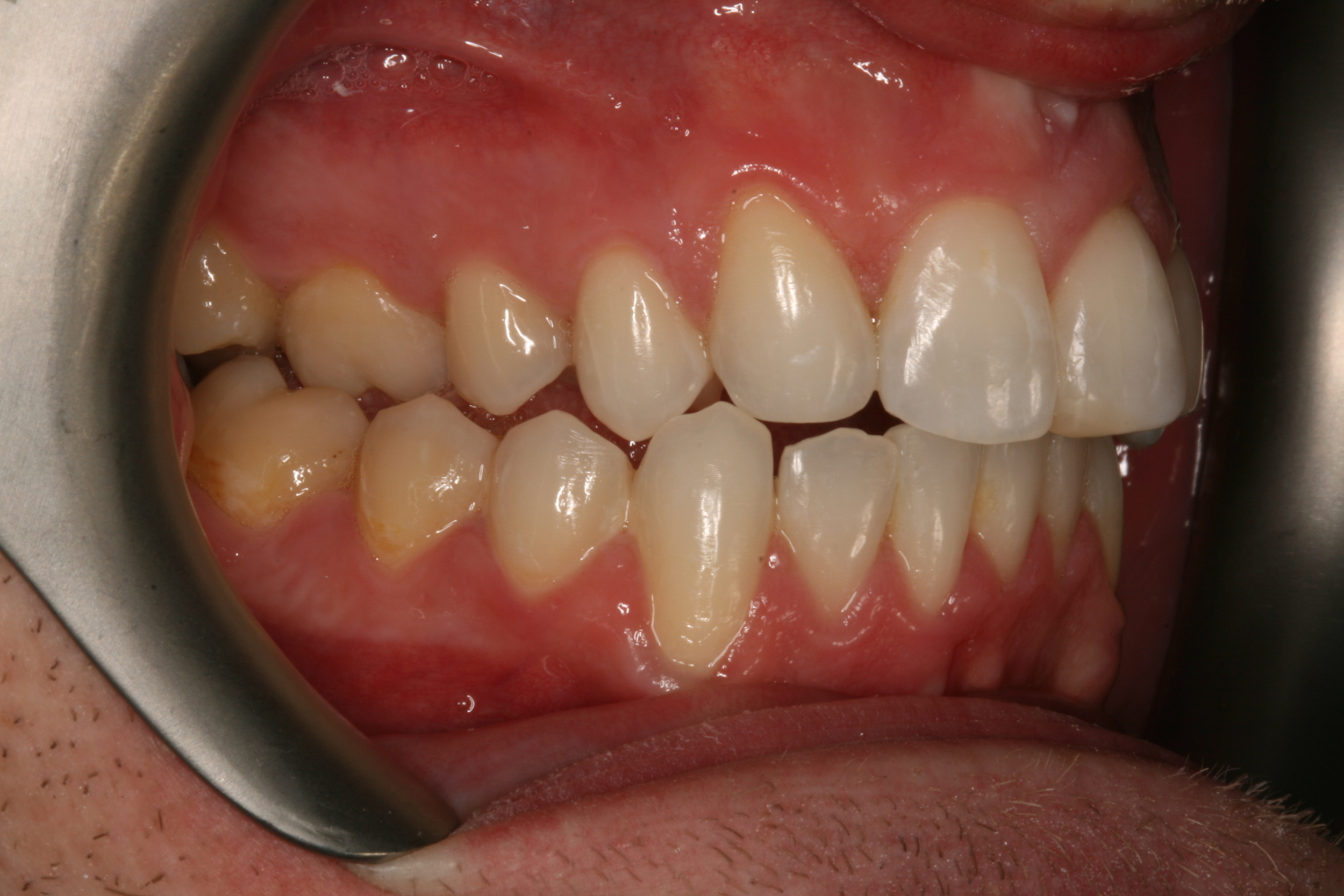 The Tuddenham Road Dental Surgery - Six_Month_Smilesa6.JPG