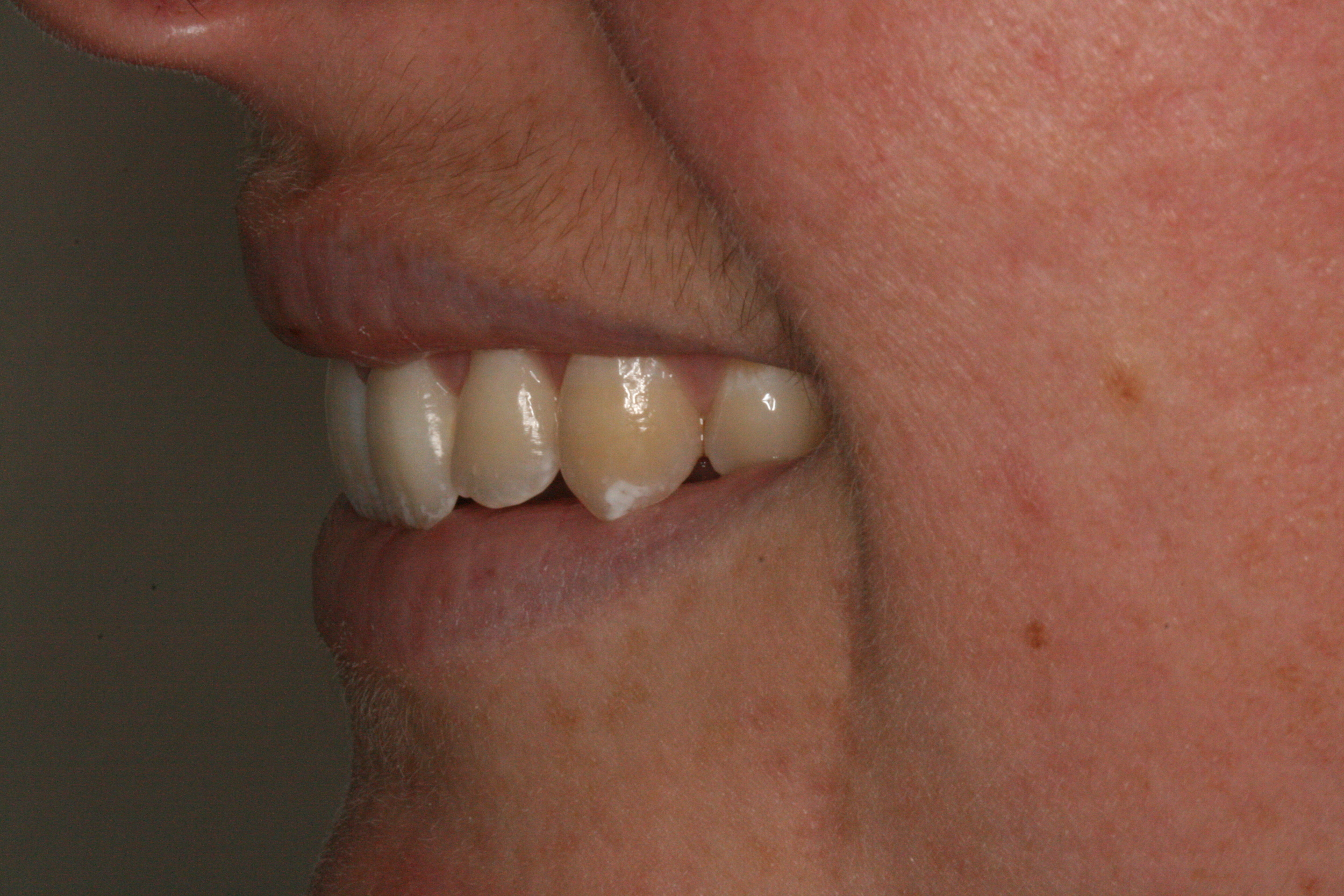 The_Tuddenham_Road_Dental_Surgery_Clear_Aligners3.JPG