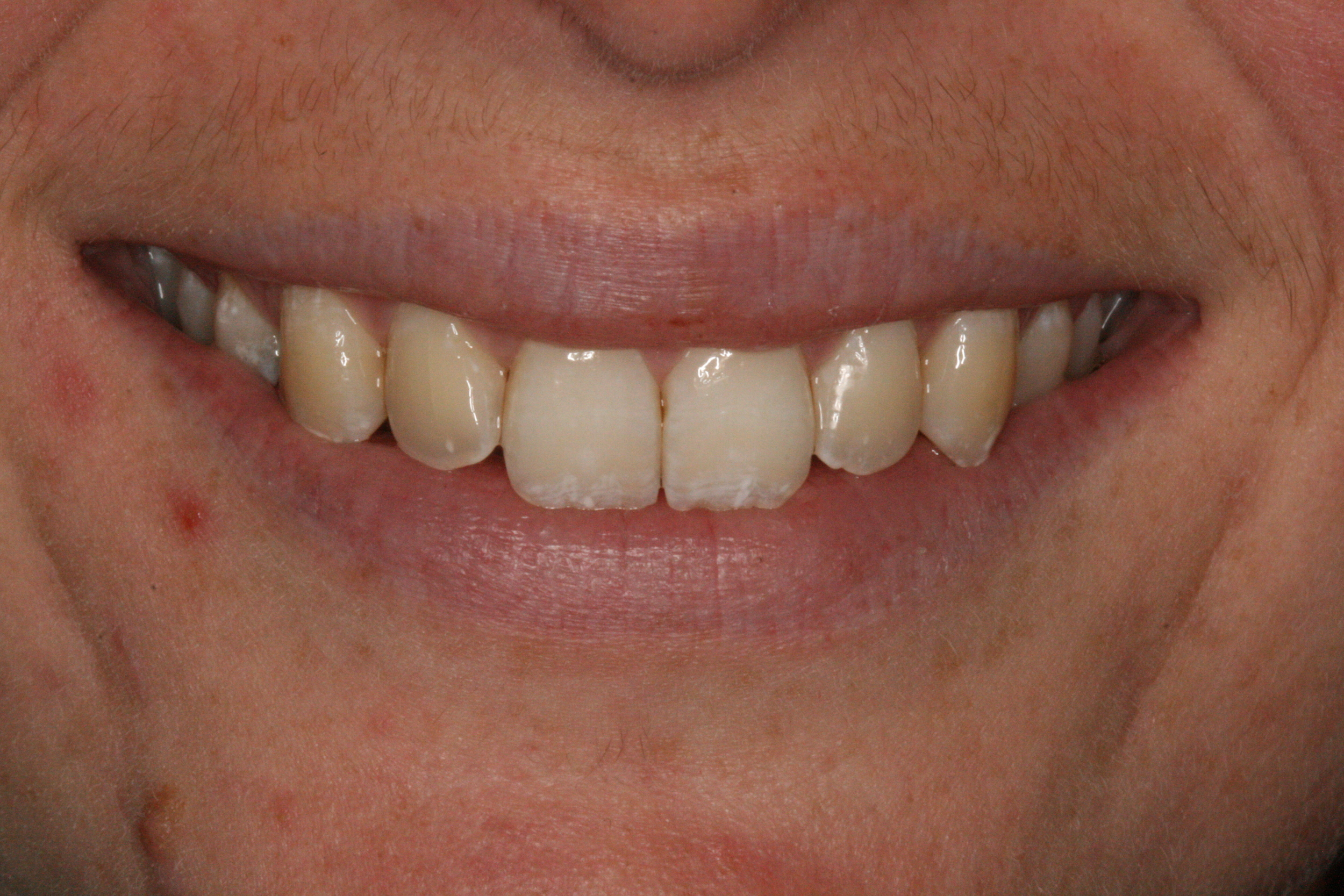 The_Tuddenham_Road_Dental_Surgery_Clear_Aligners2.JPG