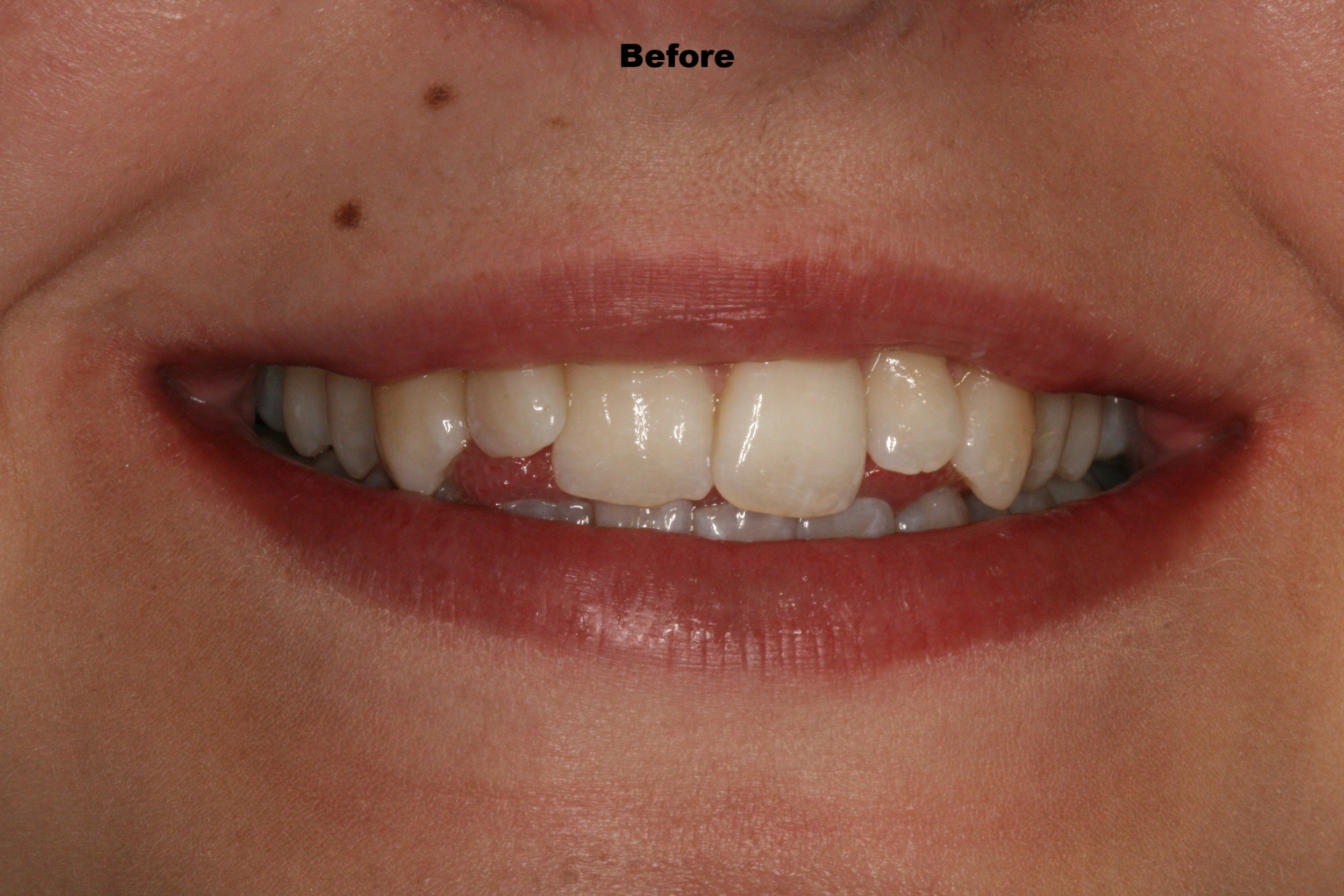 The Tuddenham Road Dental Surgery - Six_Month_Smiles1.JPG