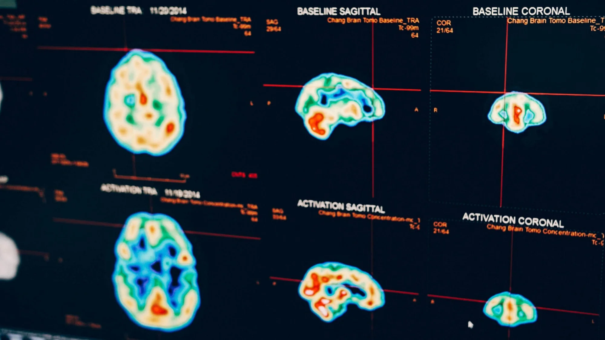 BrainScan.jpeg