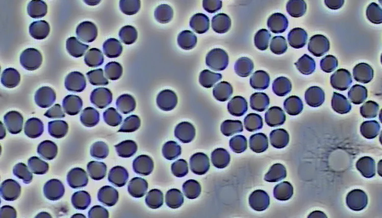blood slide showing improved health and ongoing detoxification