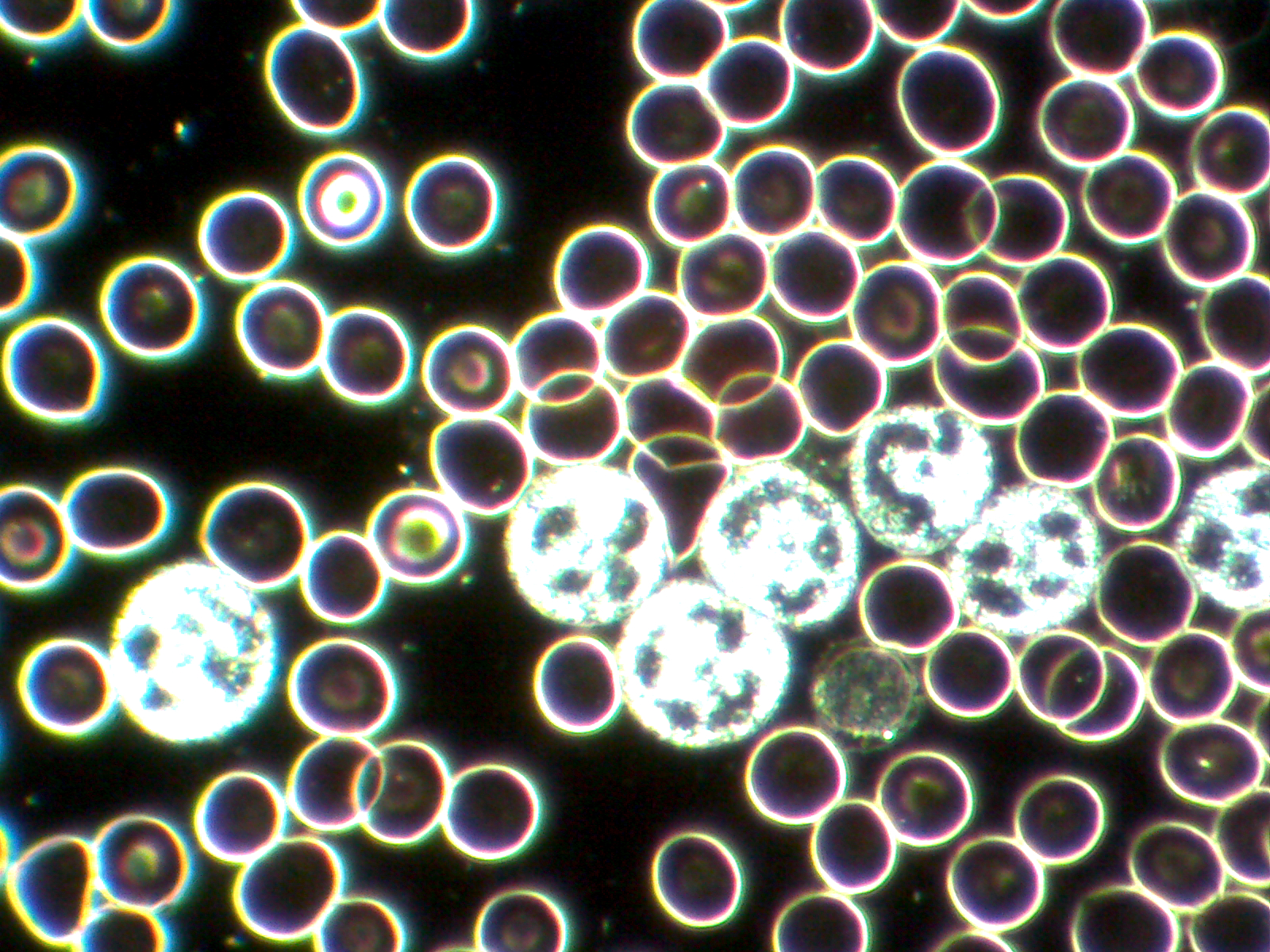 live blood viewed through a darkfield microscope
