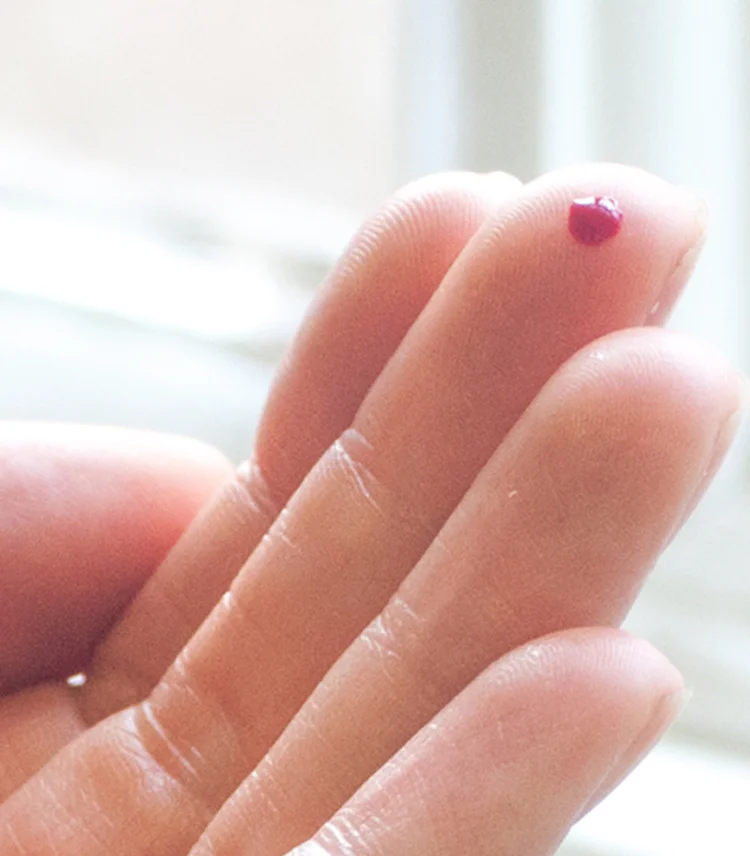 Finger prick for blood sample
