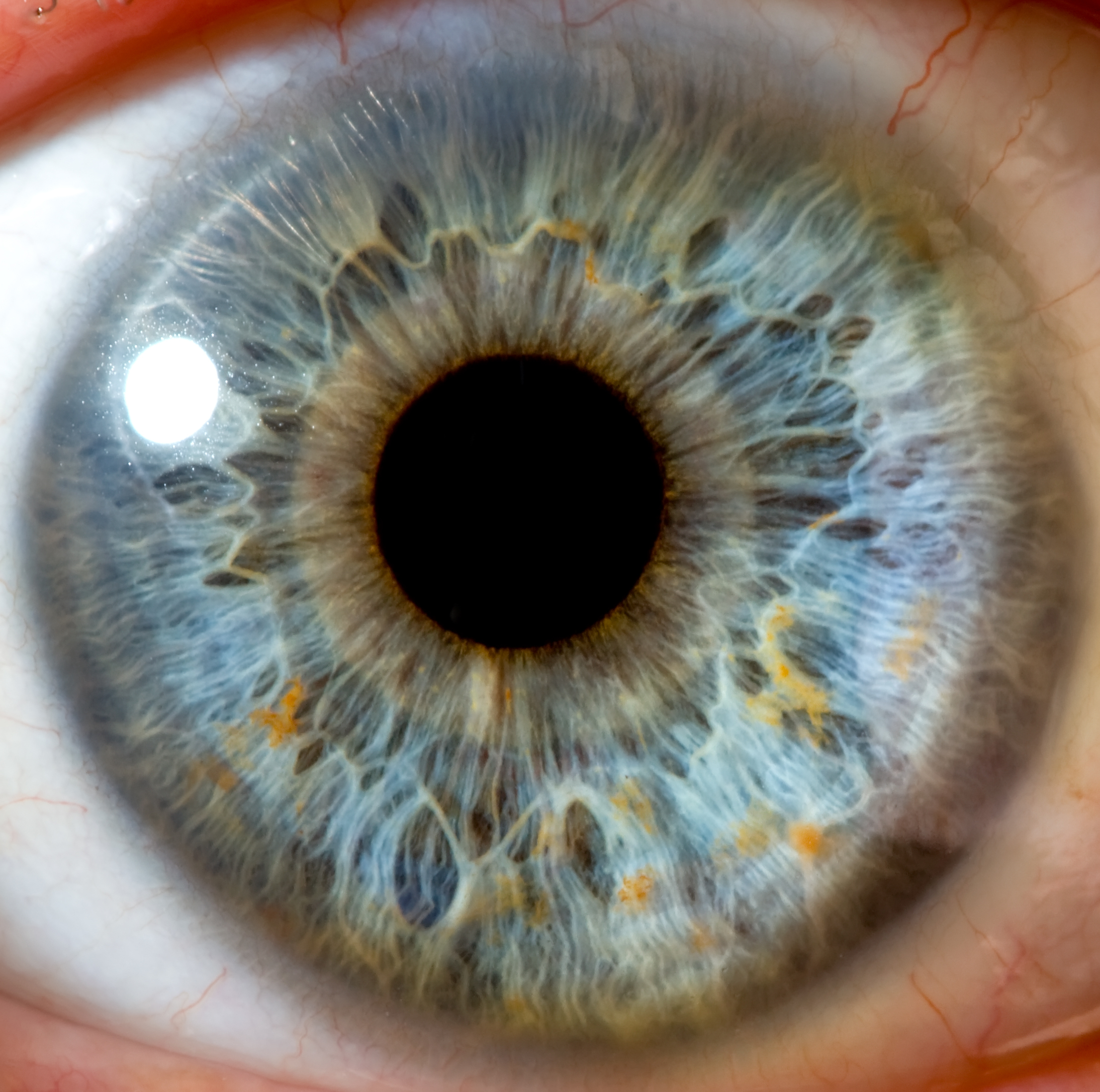 Радужка содержит пигмент. Глаукома Франк Каменецкого. Радужка глаза анатомия. Радужная оболочка глаза.