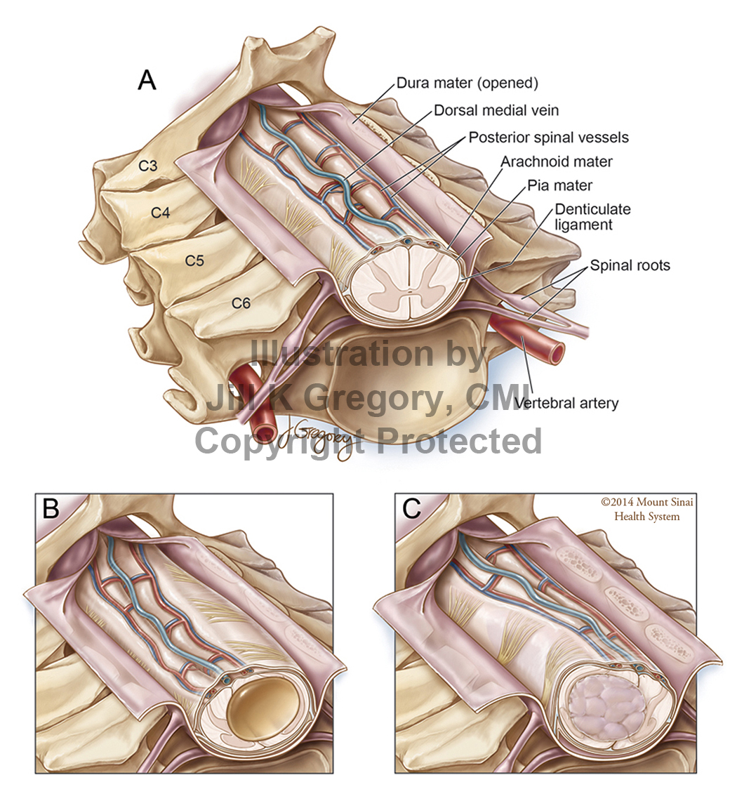 Cervical Spine: Normal Anatomy and Pathologies